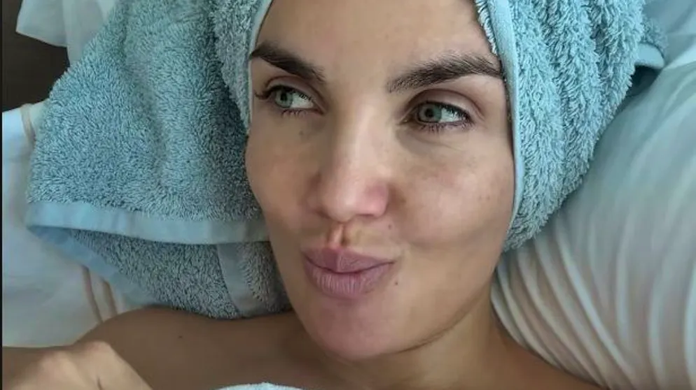 Ecco cos'è successo. Elettra Lamborghini racconta un incidente avvenuto sotto la doccia: «Sacrilegio»