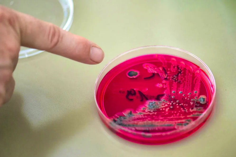 Ecco come si presenta la salmonella.