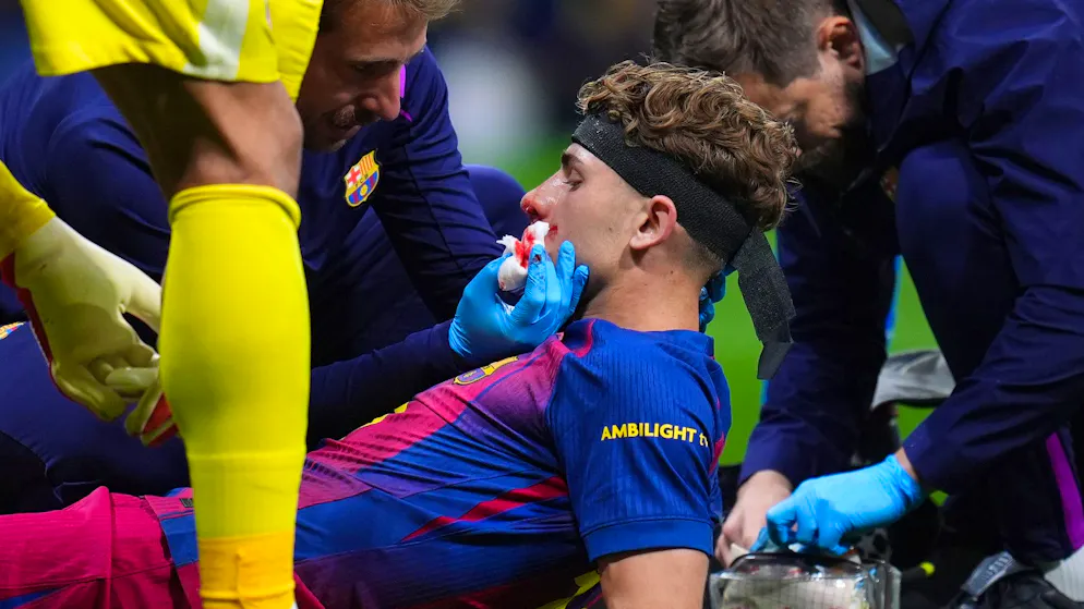 Shocking moments in Madrid and Liverpool. Fermin's face bleeds profusely after studs hit - big worries for Ekitike