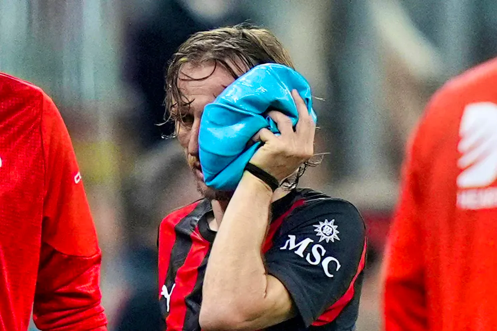 Before the World Cup: Modric needs surgery after breaking his cheekbone - Gallery. Luka Modric was injured just a few weeks before the start of the World Cup.