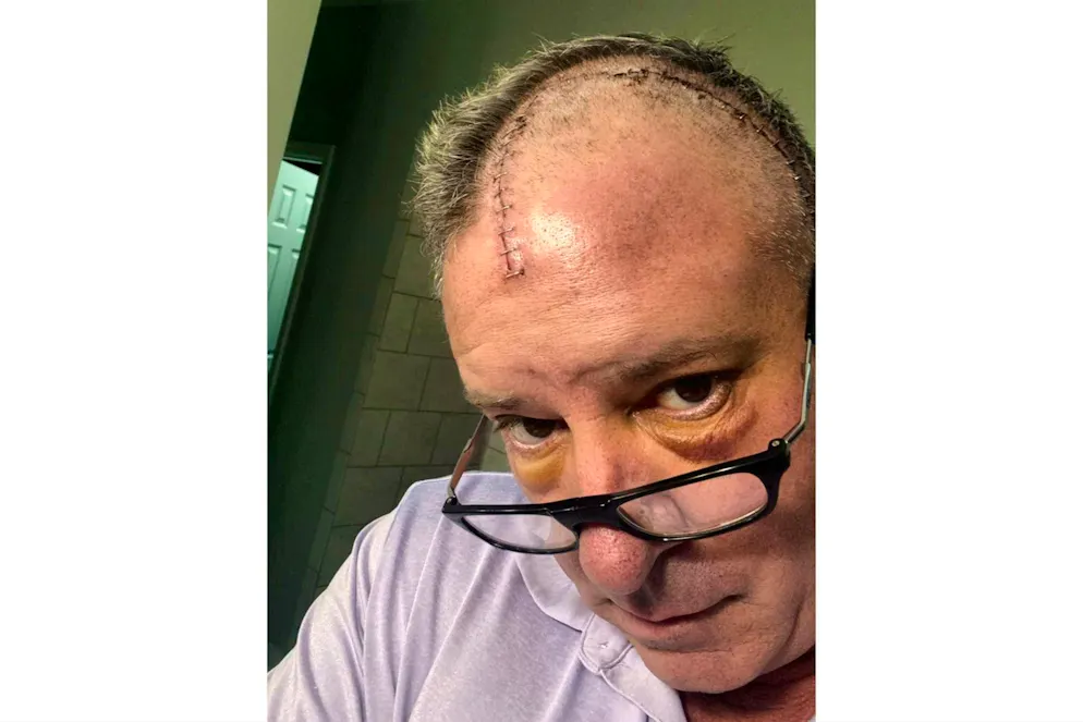 A Mark Toothaker è stato diagnosticato un tumore grande come una pallina da tennis nel cervello.