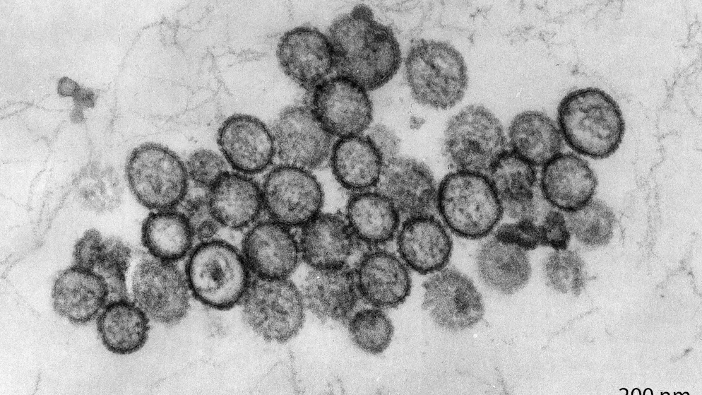 Currently in isolation. Hantavirus alert spreads - person under observation in Geneva