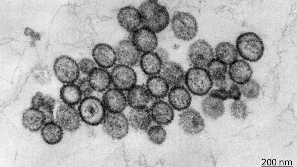 Hantavirus: Schiffspassagiere können vorerst nicht von Bord – Gallery. Bislang sind drei Passagiere der «Hondius» gestorben, ein niederländisches Ehepaar und ein Deutscher. (Symbolbild)