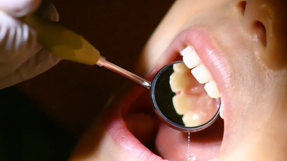 France. «Il m'a mutilé» - Un dentiste fait scandale