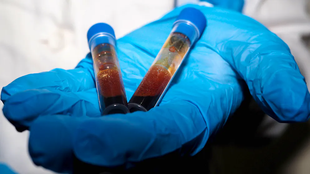 Hantavirus. Des membres du personnel d'un hôpital néerlandais en quarantaine après des erreurs