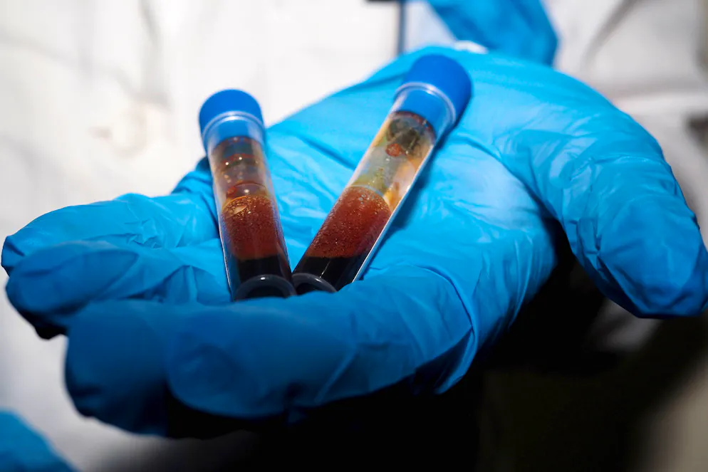 Des erreurs de procédure ont été commises pendant un prélèvement sanguin et l'élimination de l'urine du patient (image d'illustration).