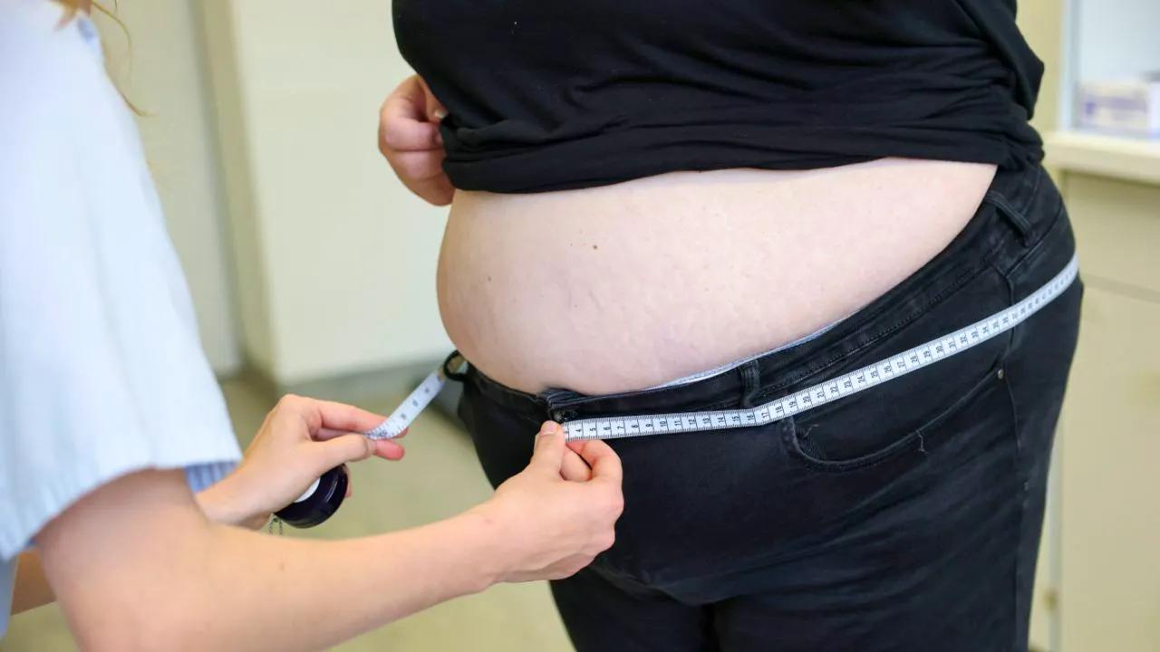 Gesundheit. Fettleibigkeit verlagert sich zunehmend in ärmere Länder