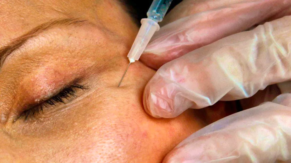 On Thursday, a 27-year-old man will stand trial. Among other things, he is alleged to have carried out illegal beauty treatments without a license. (symbolic image)