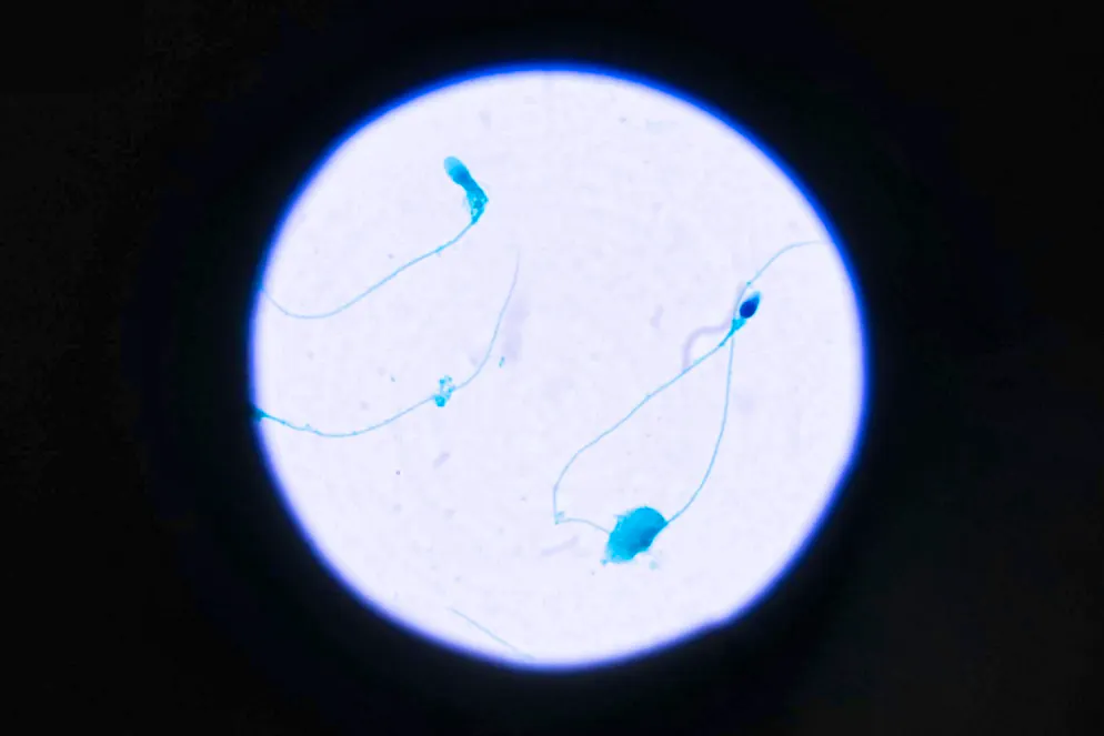 Sperm under the microscope.