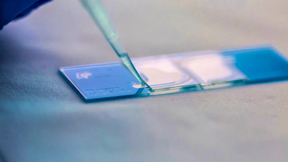 Examination of sperm quality: Swiss data from 2021 shows surprising stability. (symbolic image)